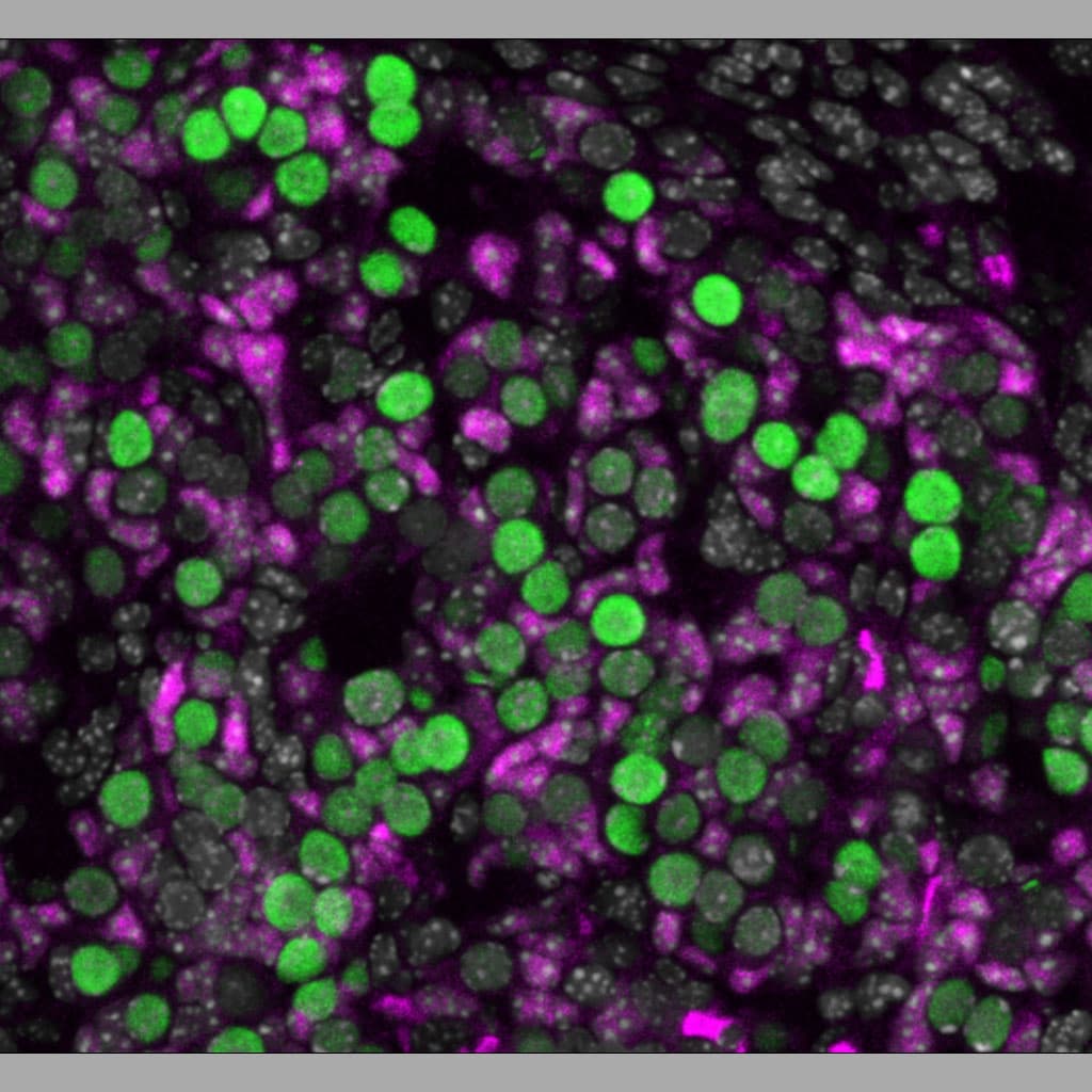 FOXL2 Antibody NB100-1277