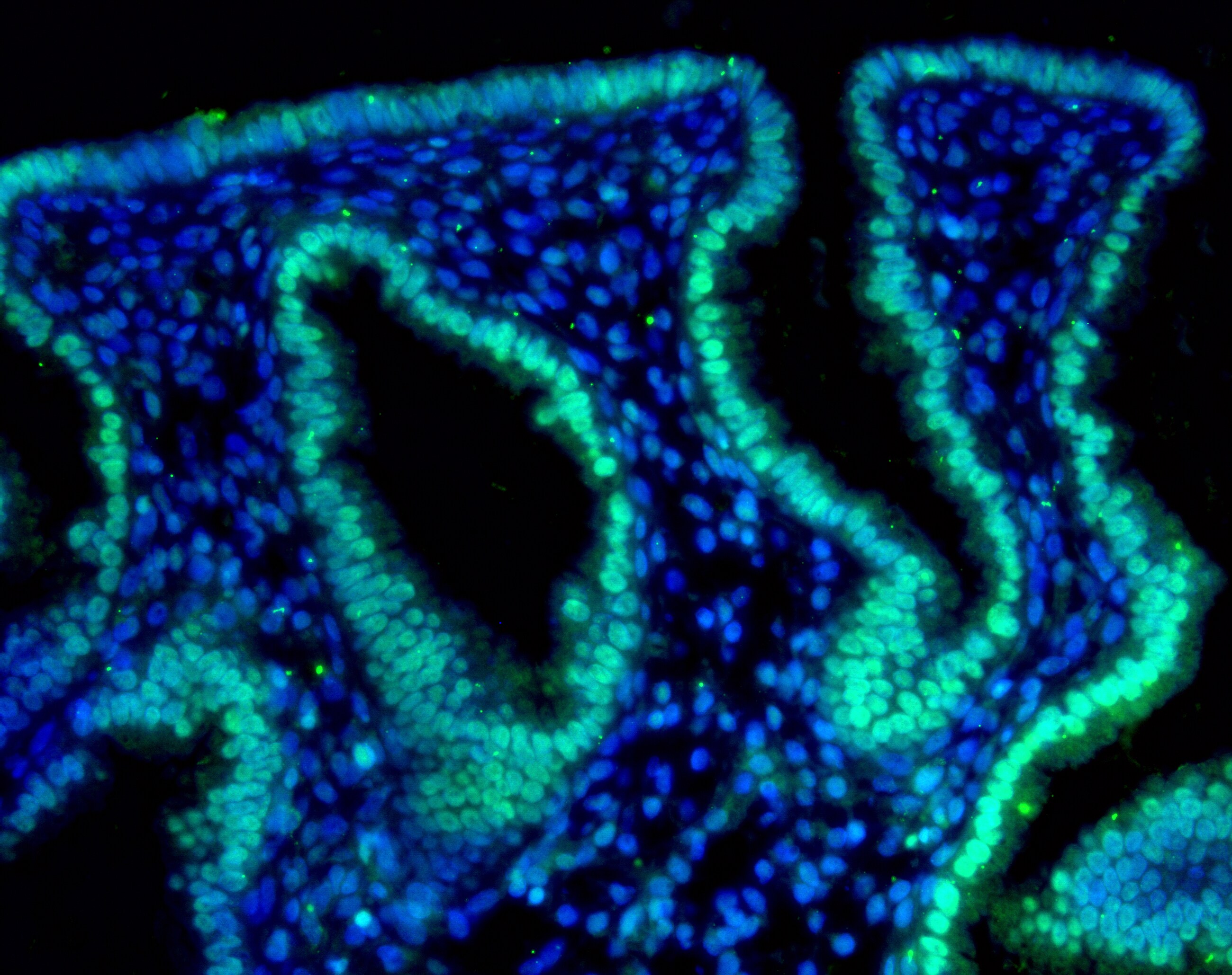 HIF-2 alpha/EPAS1 Antibody (ep190b) NB100-132