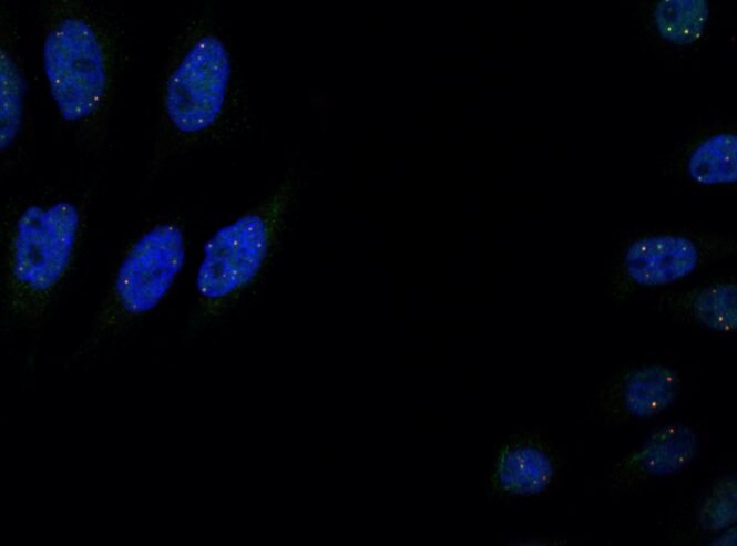 WDR79 Antibody NB100-68252