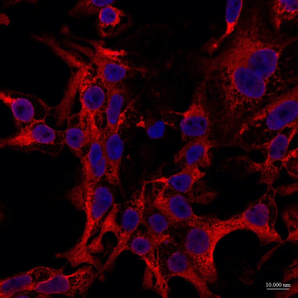 RanBP1 Antibody - BSA Free NB100-79814