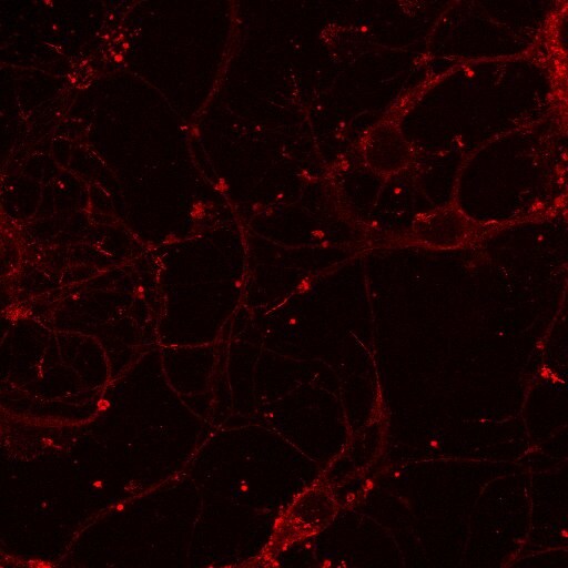 NMDAR1 Antibody (R1JHL) NB300-118