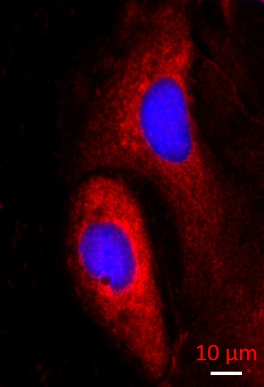 DNCIC1 Antibody (74.1) NB300-726