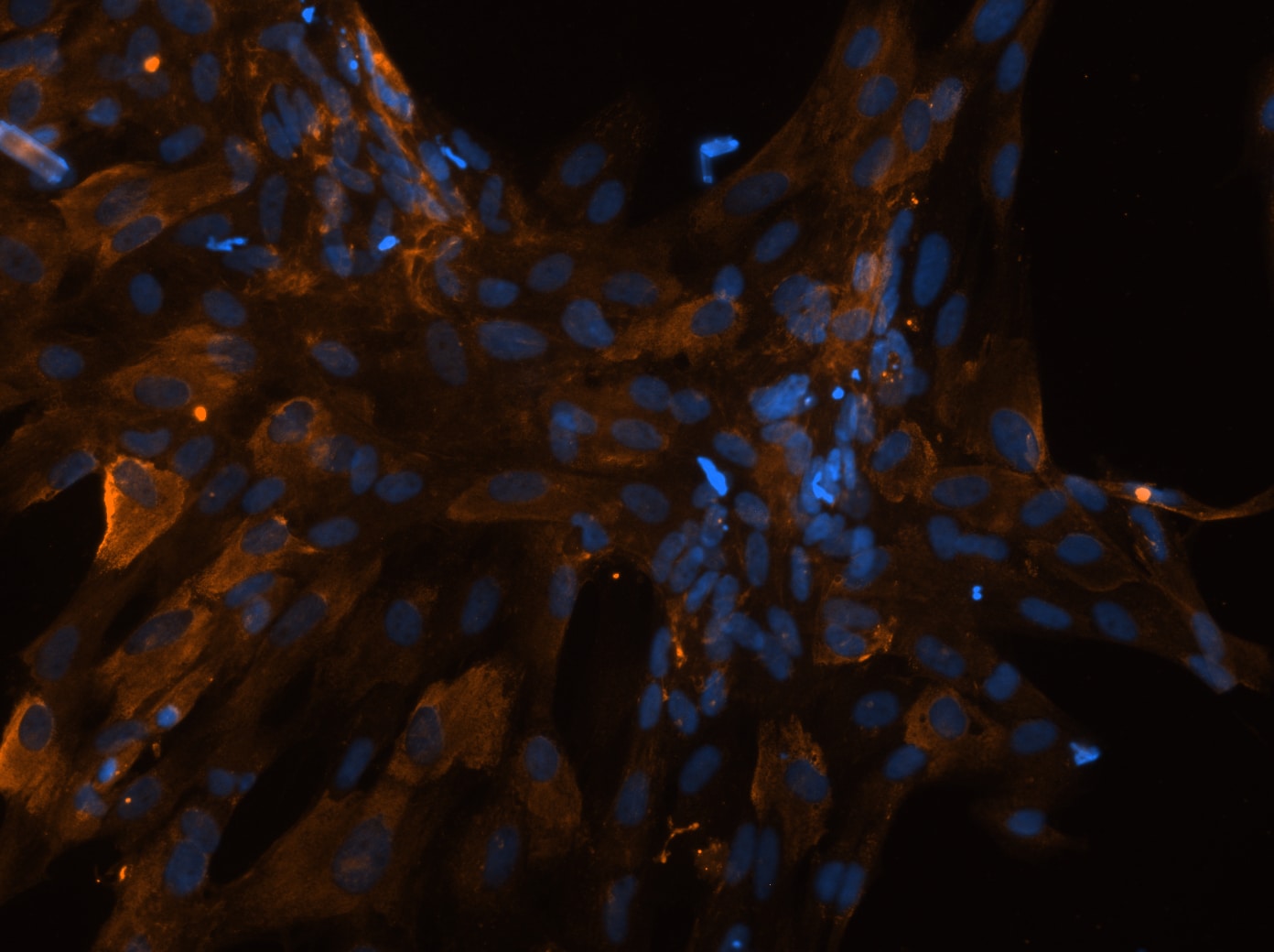 Collagen I alpha 1 Antibody (COL-1) NB600-450