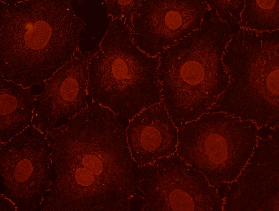 Fascin 2 Antibody - BSA Free NBP1-79776