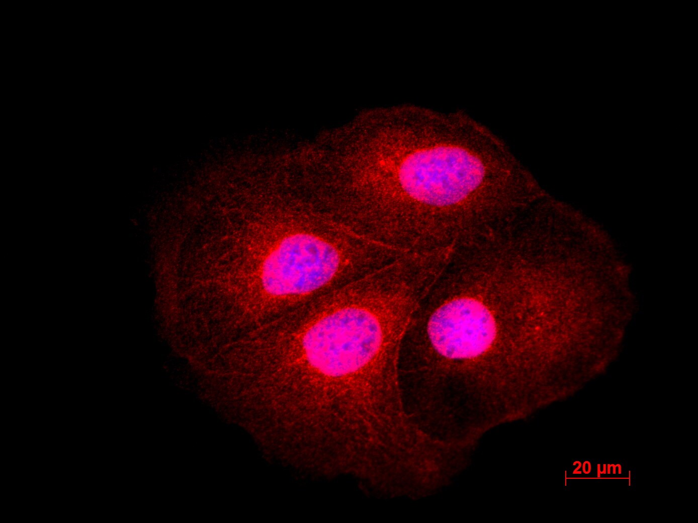 LIS1 Antibody - BSA Free NBP1-87769