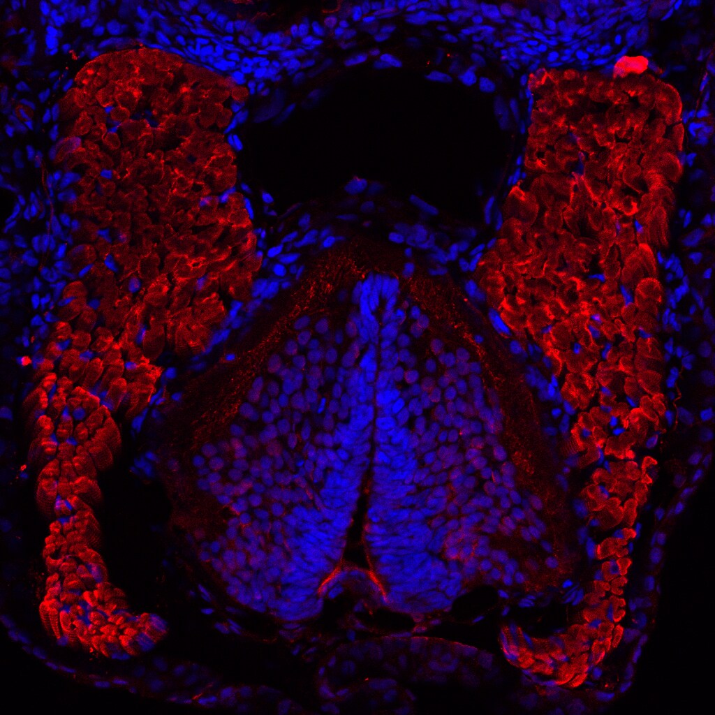 Actin Alpha 1 Cardiac Muscle Antibody (22D3) - BSA Free NBP1-97725
