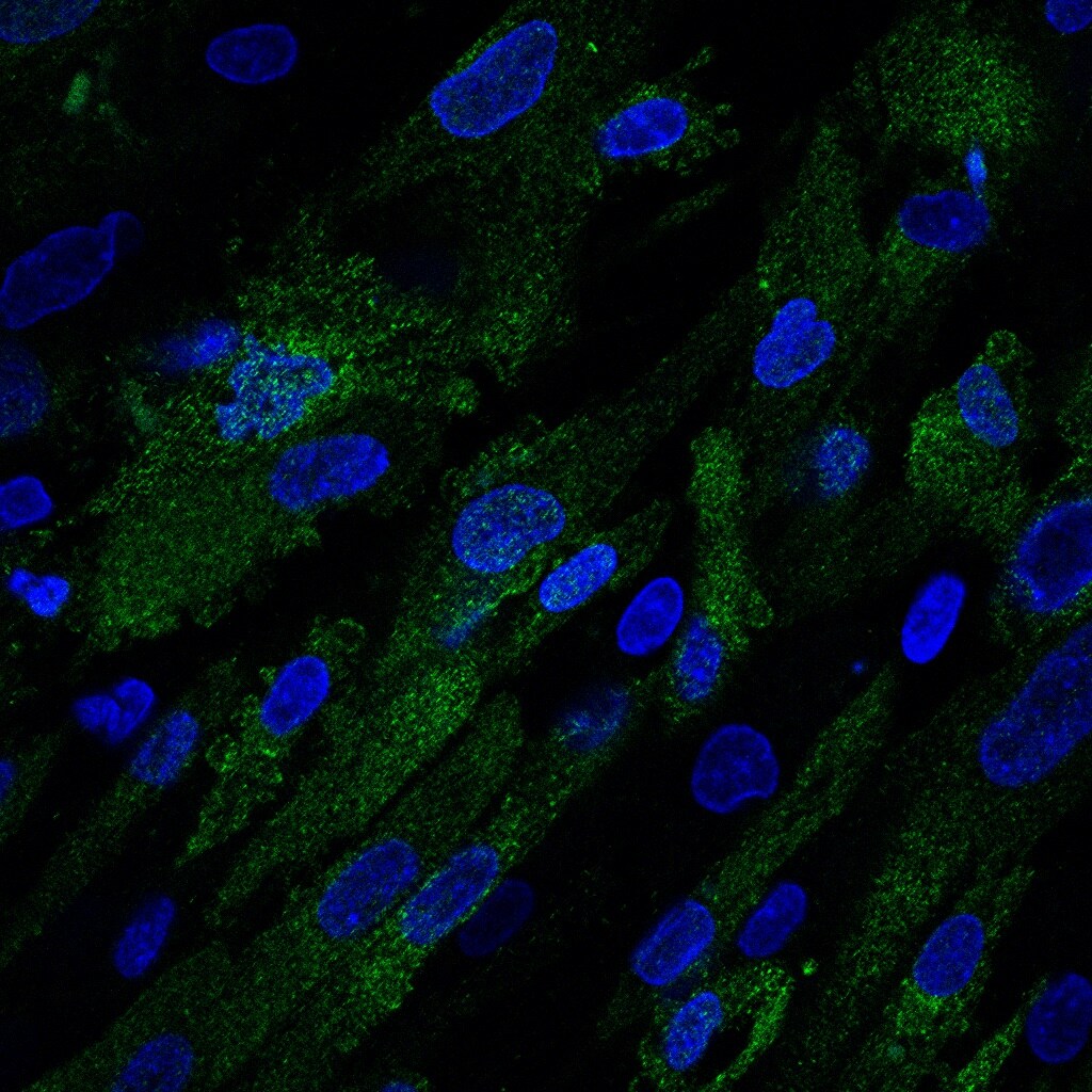 CD9 Antibody (5G6) NBP2-22187