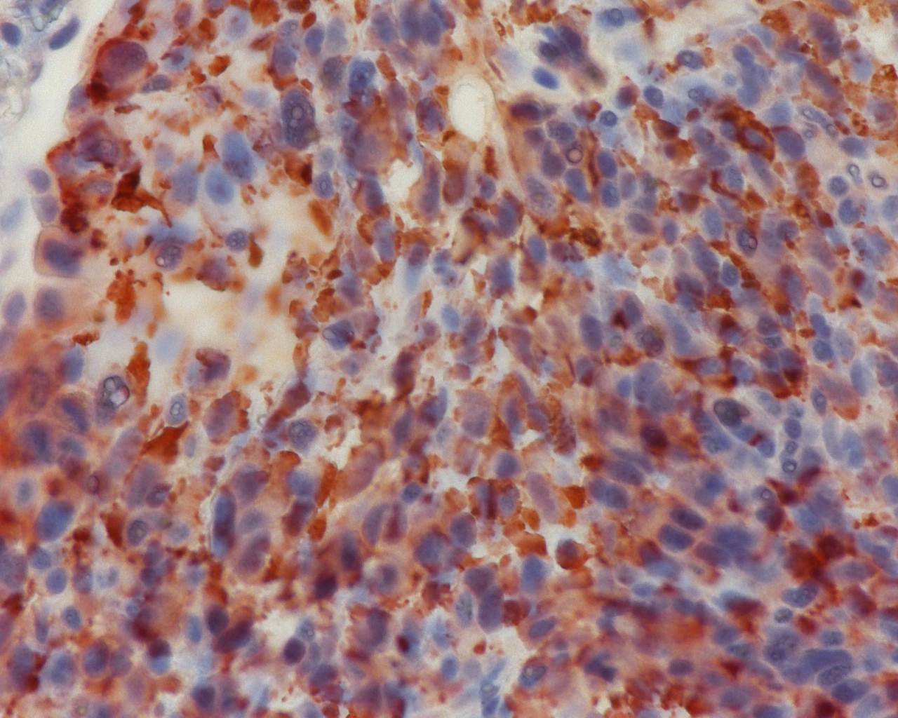 mCherry Antibody - BSA Free NBP2-25157