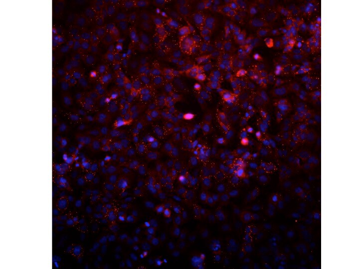 AVL9 Antibody - BSA Free NBP2-14337