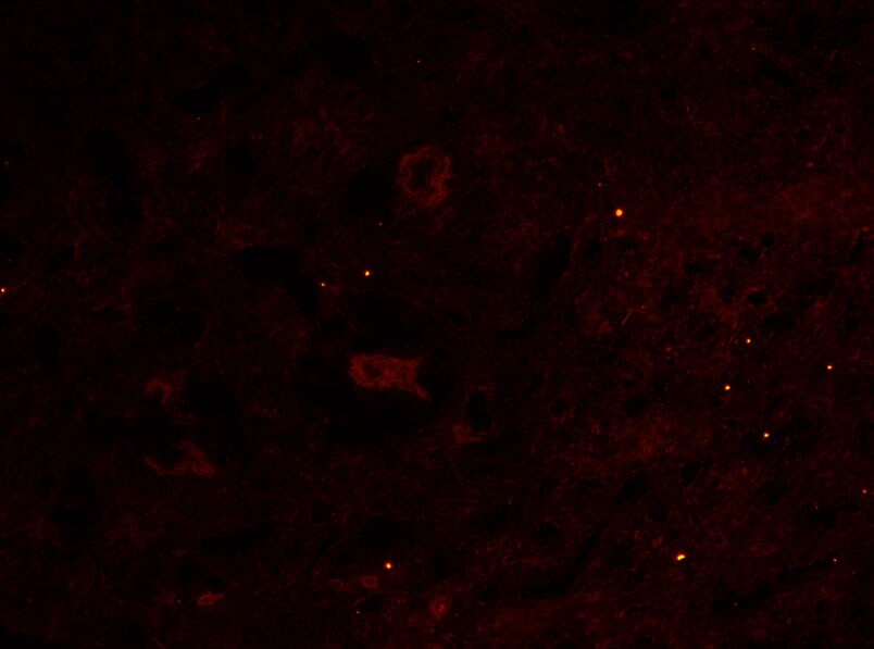 Angiopoietin-1 Antibody (MM0019-26B10) - Azide and BSA Free NB110-85464