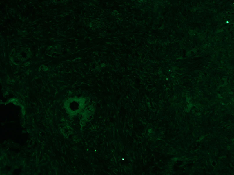 Angiopoietin-2 Antibody (MM0020-1F29) - Azide and BSA Free NB110-85467