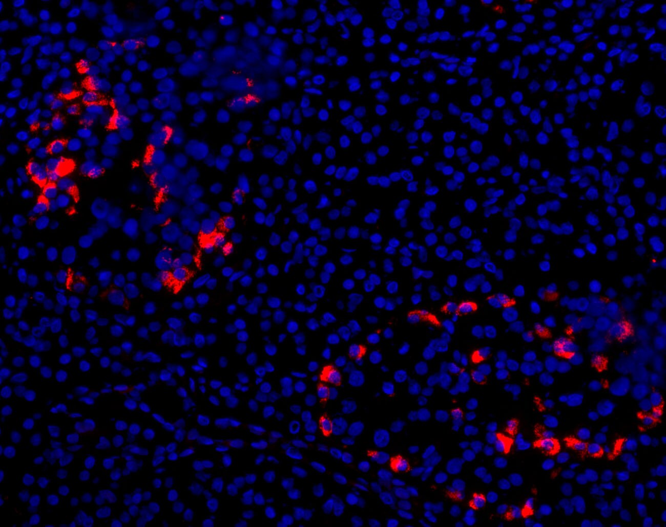 CFTR Antibody (CF3) NB300-511