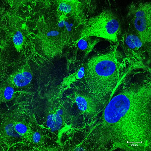 Collagen I Antibody - BSA Free NB600-408