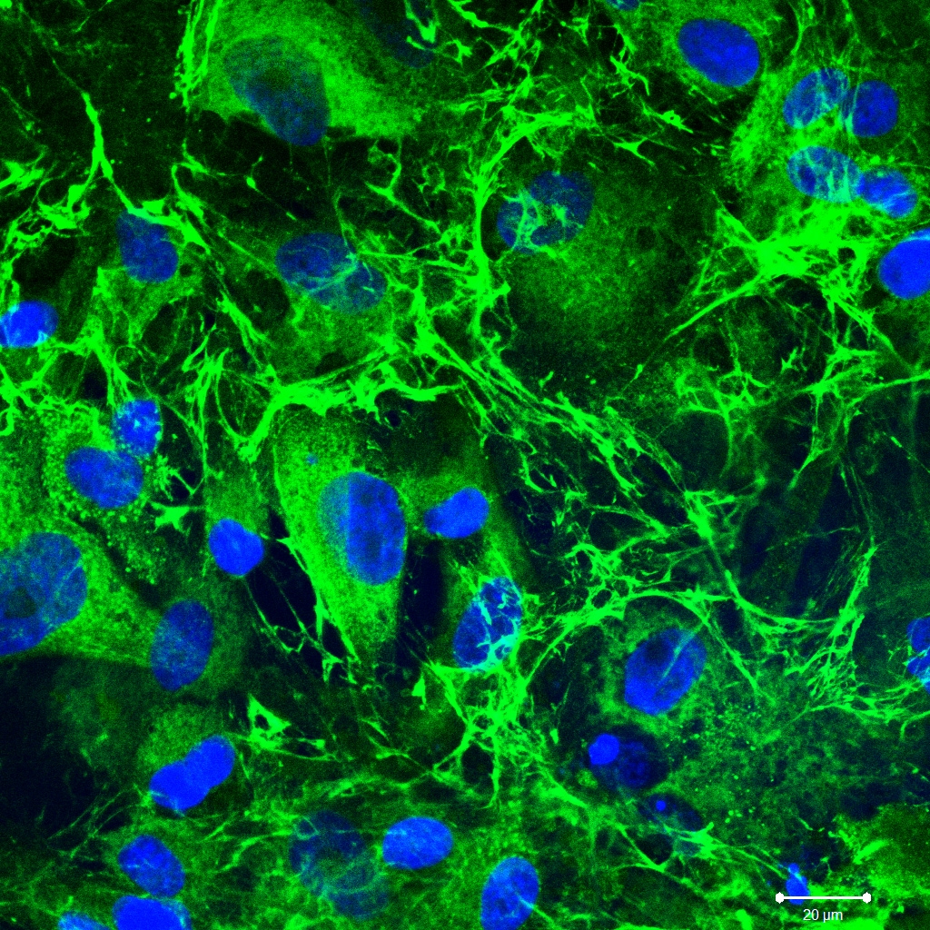 Collagen III alpha 1/COL3A1 Antibody - BSA Free NB600-594
