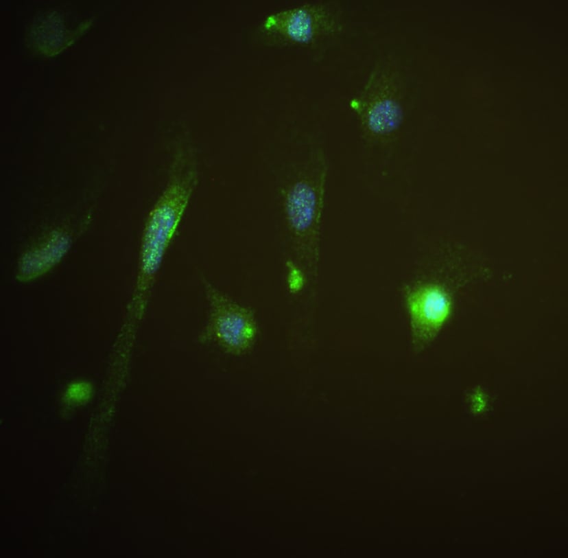 Dectin-1/CLEC7A Antibody NBP1-45514