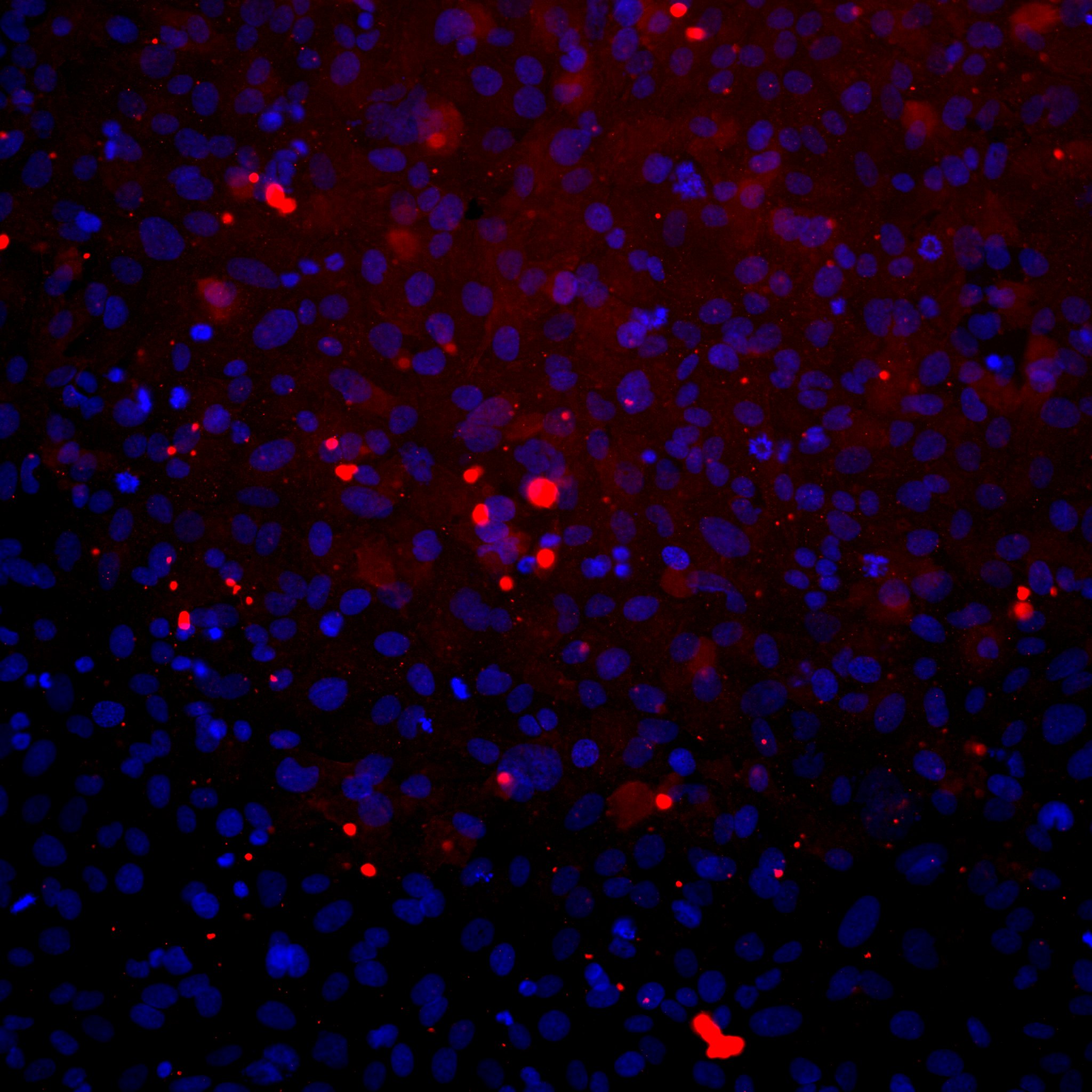 FRMD1 Antibody - BSA Free NBP1-90832
