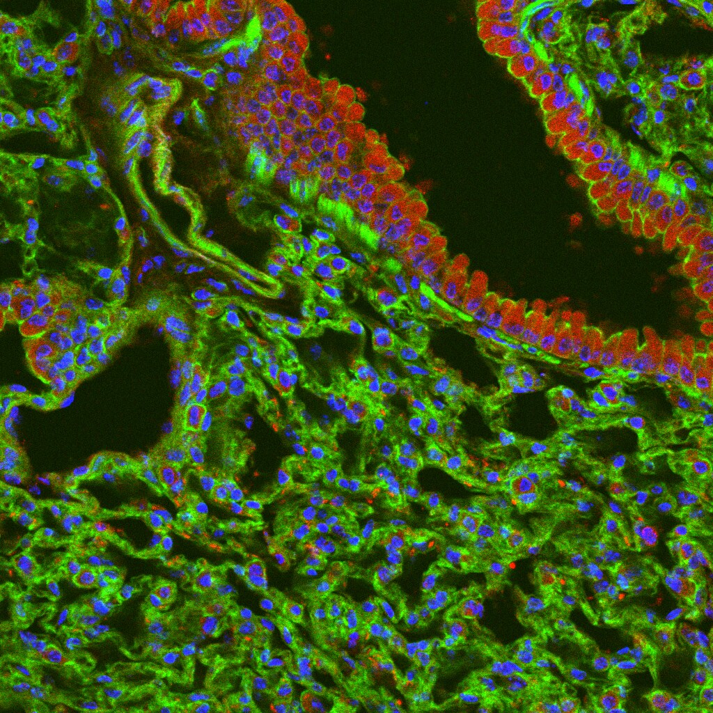 IL-17E/IL-25 Antibody (RM0263-5J46) - Azide and BSA Free NBP2-11677