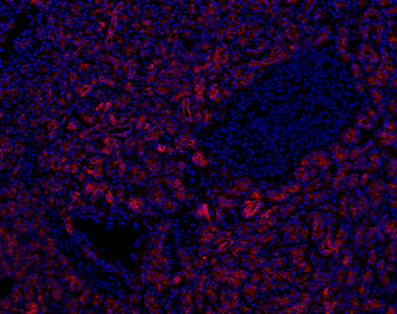 SLC28A3 Antibody - BSA Free NBP1-84418