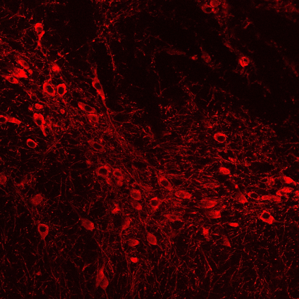 Tyrosine Hydroxylase Antibody - Azide Free NB300-110
