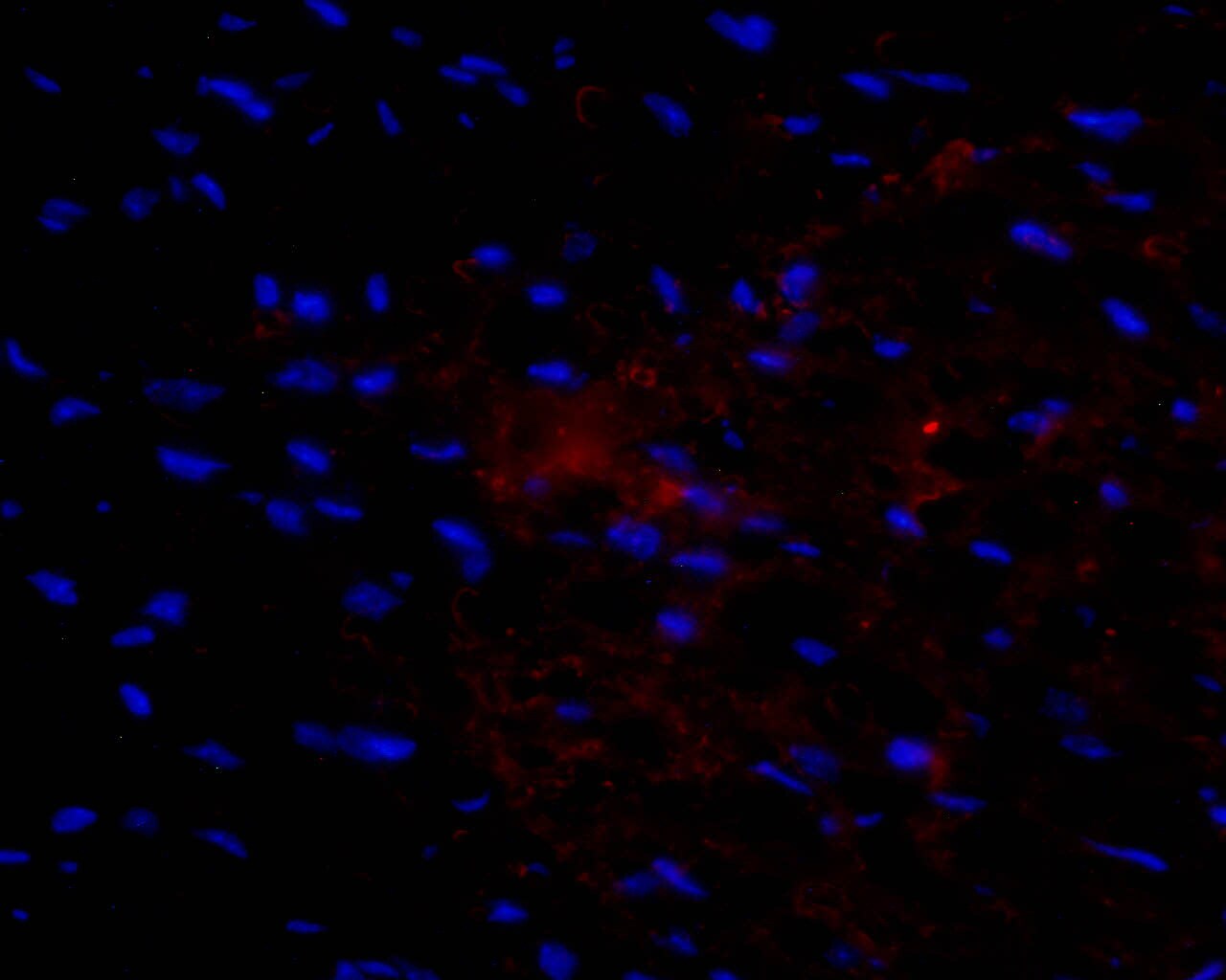VEGF Antibody (VG76e) - BSA Free NB100-648