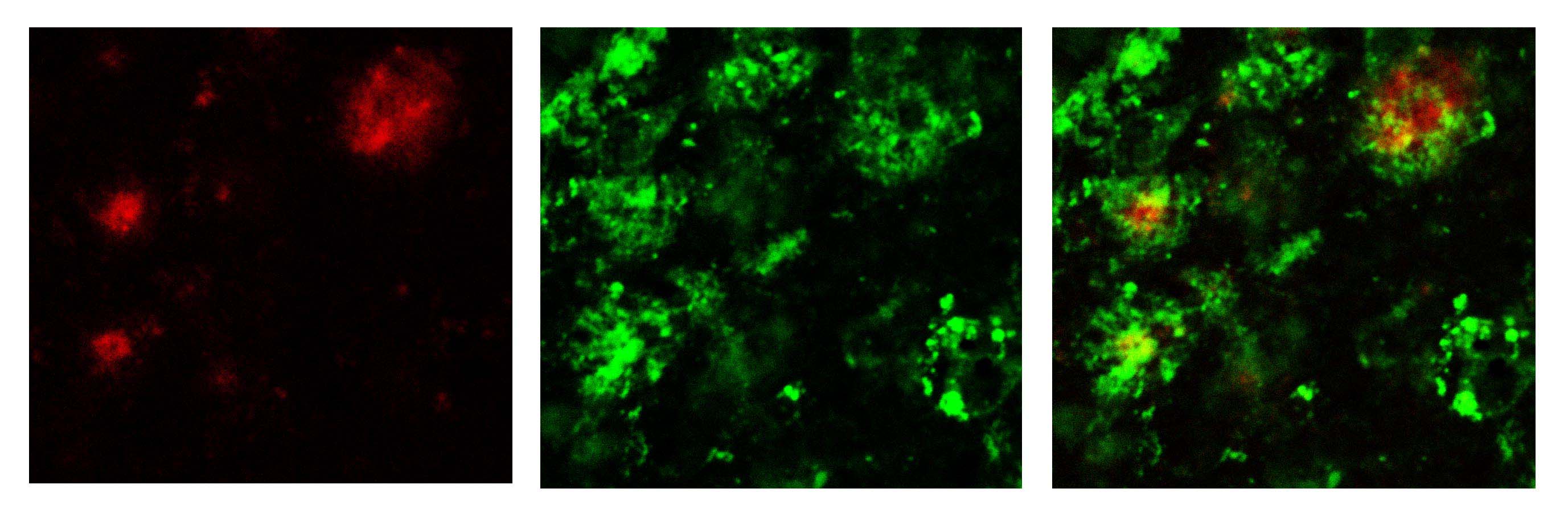 beta Amyloid [Pyro Glu11] Antibody - Azide and BSA Free NBP1-44070