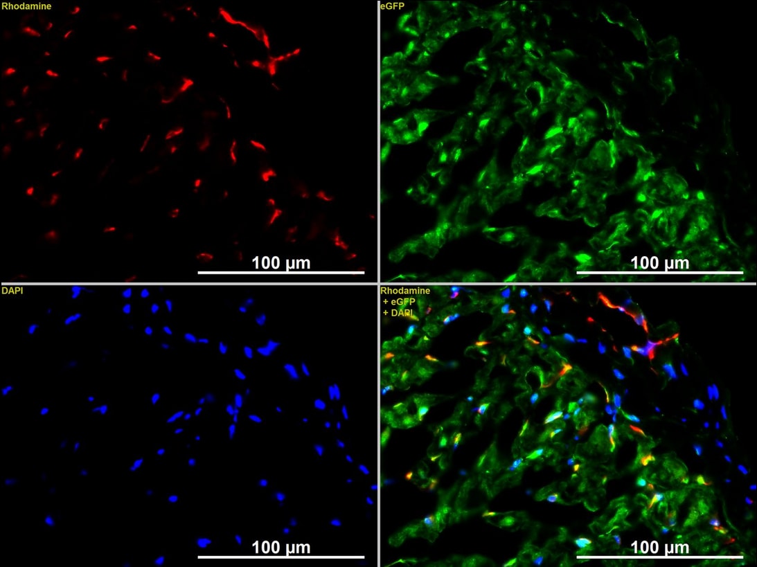CD31/PECAM-1 Antibody (JC/70A) - BSA Free NB600-562