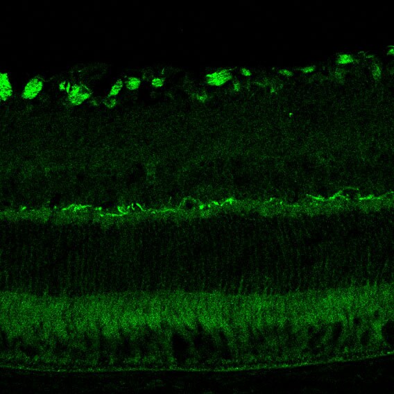 Optineurin Antibody - BSA Free NBP1-84682