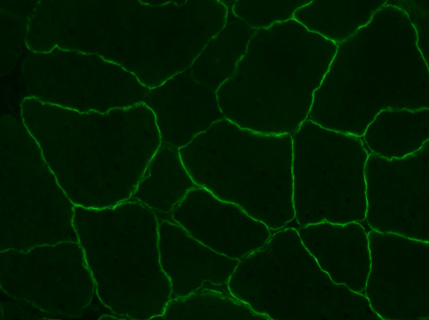 gamma Sarcoglycan Antibody - BSA Free NBP1-59744
