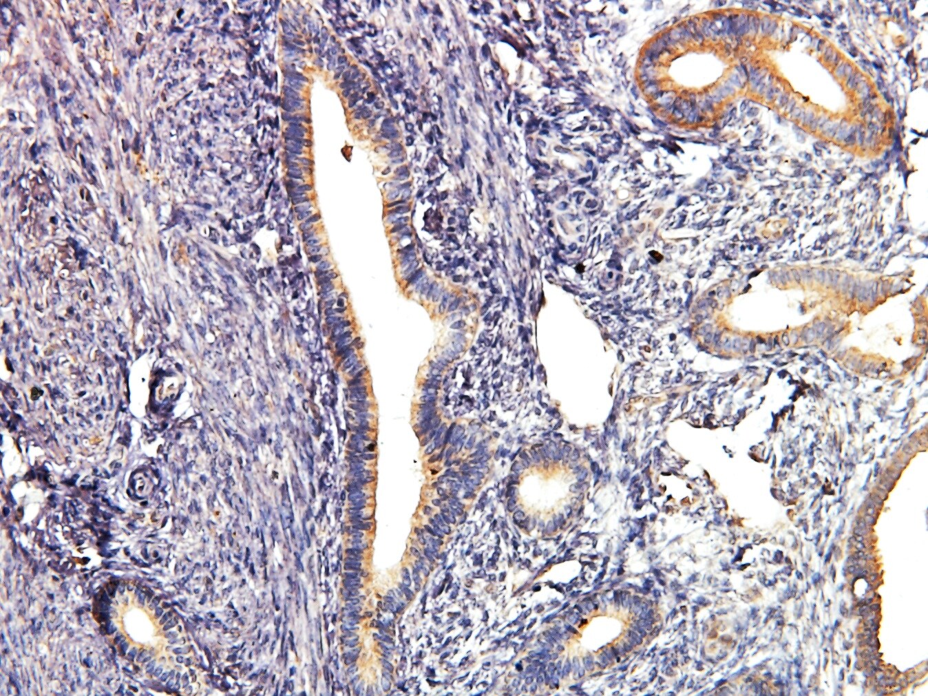 AKT1 Antibody (3A3) NBP1-51602