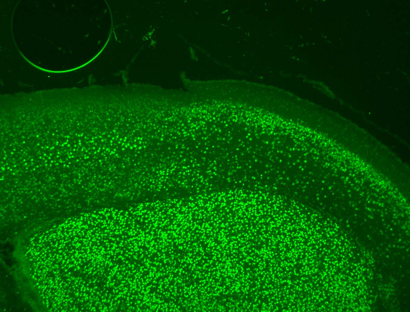 BCL11B Antibody NB100-2600