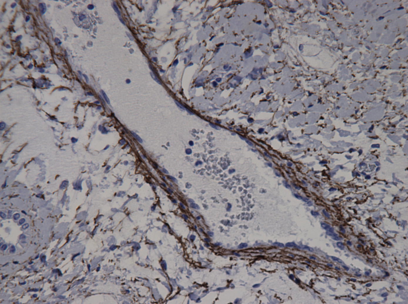 Elastin Antibody (BA-4) NB100-2076