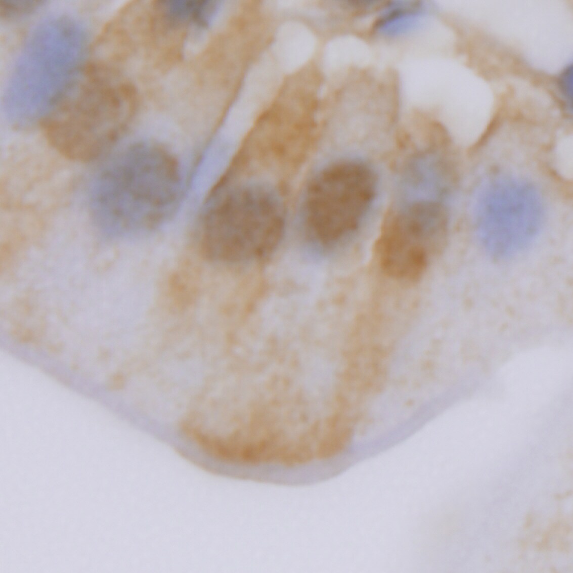 HIF-2 alpha/EPAS1 Antibody - BSA Free NB100-122