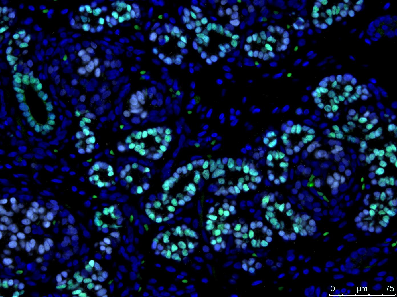 TCF-2/HNF-1 beta Antibody - BSA Free NBP1-89680