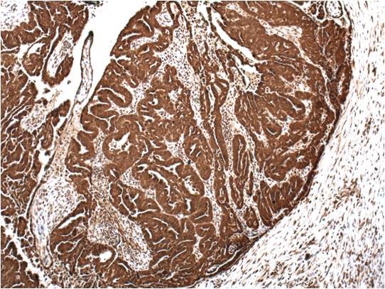 HOXA11 Antibody - BSA Free NBP1-80228