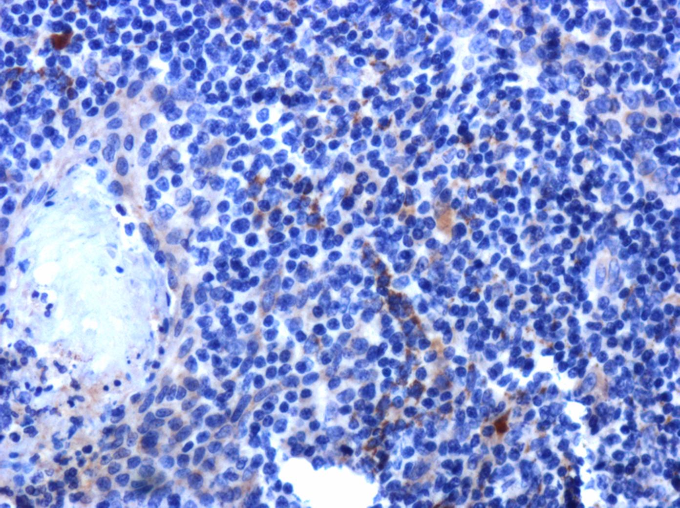 IL-2 Antibody - BSA Free NBP2-16948