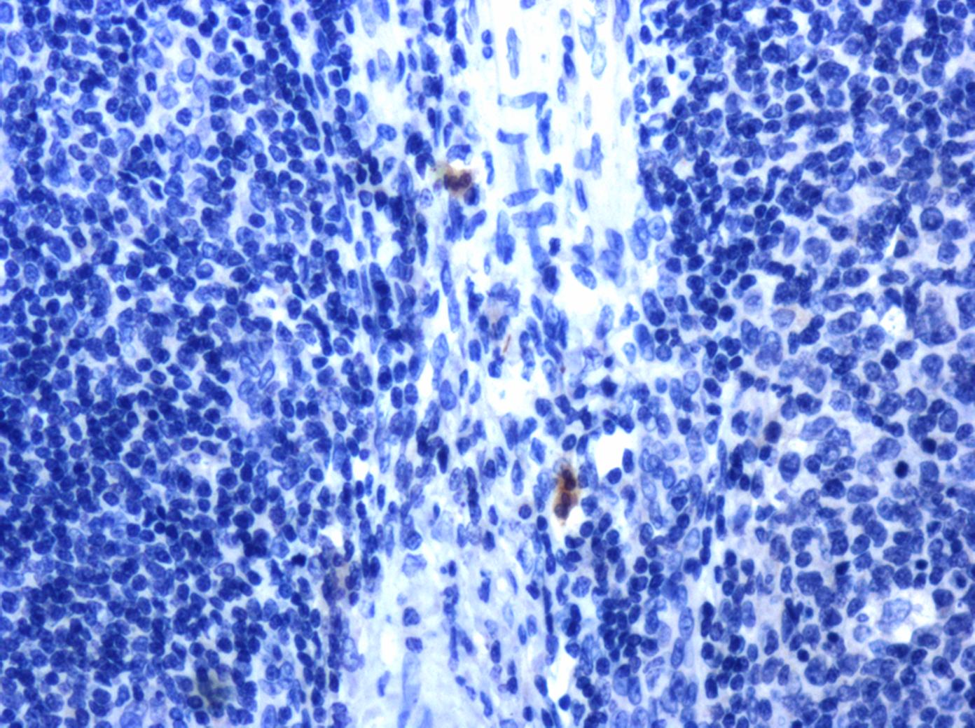 IL-6 Antibody (OTI3G9) NBP1-47810