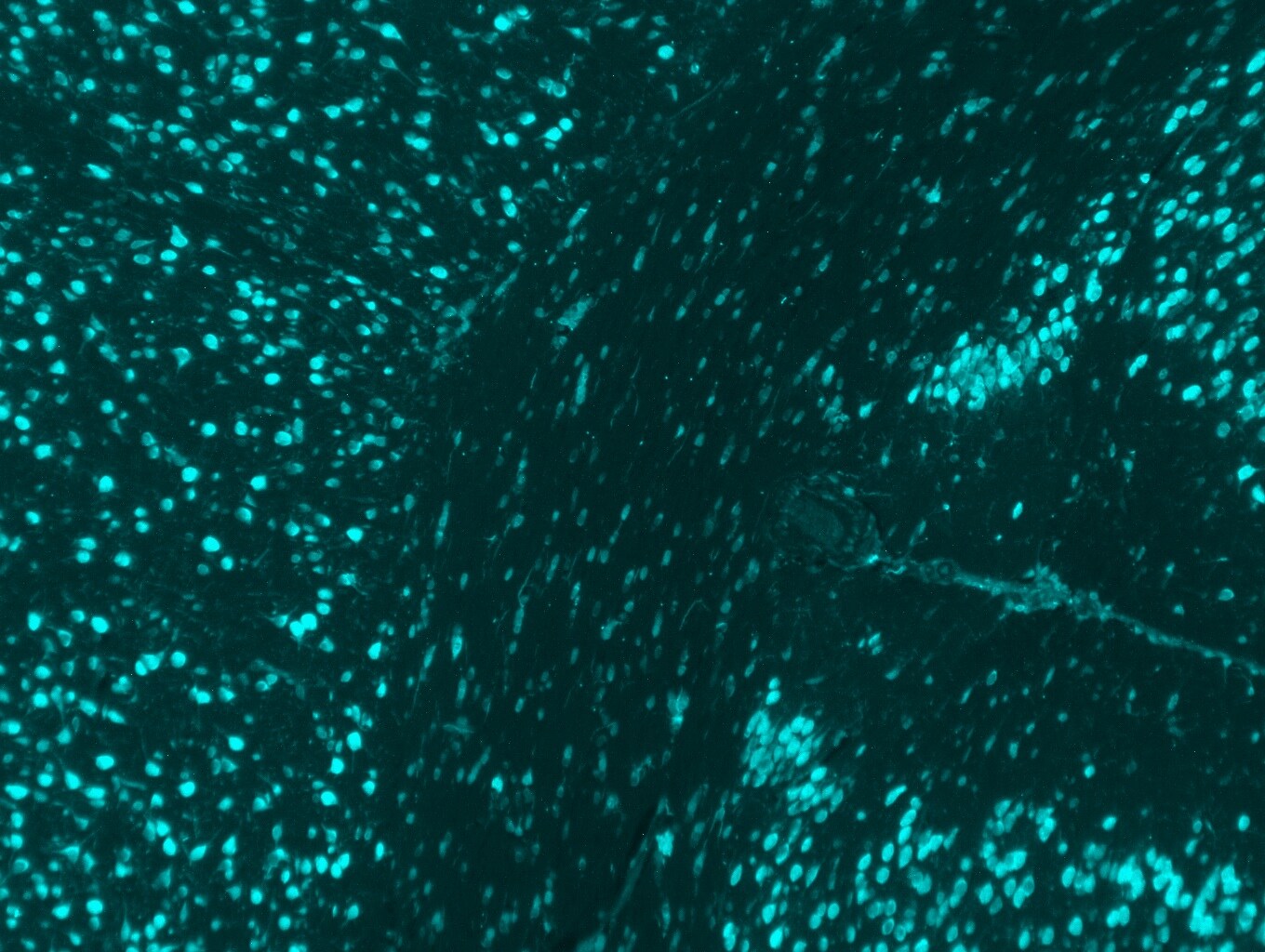 AIF-1/Iba1 Antibody NB100-1028