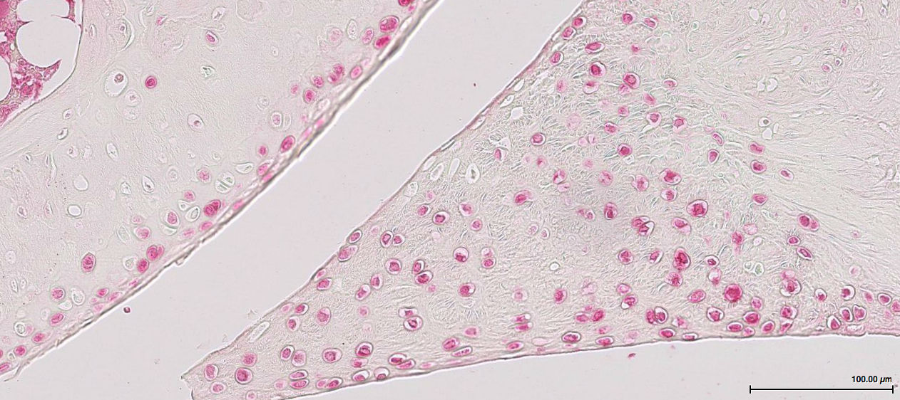 LC3A Antibody - BSA Free NB100-2331