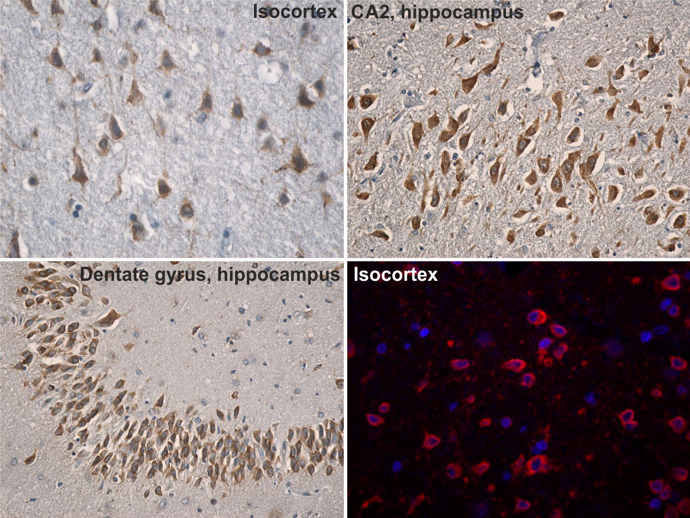 Nicotinic Acetylcholine R alpha 7/CHRNA7 Antibody NBP1-52375