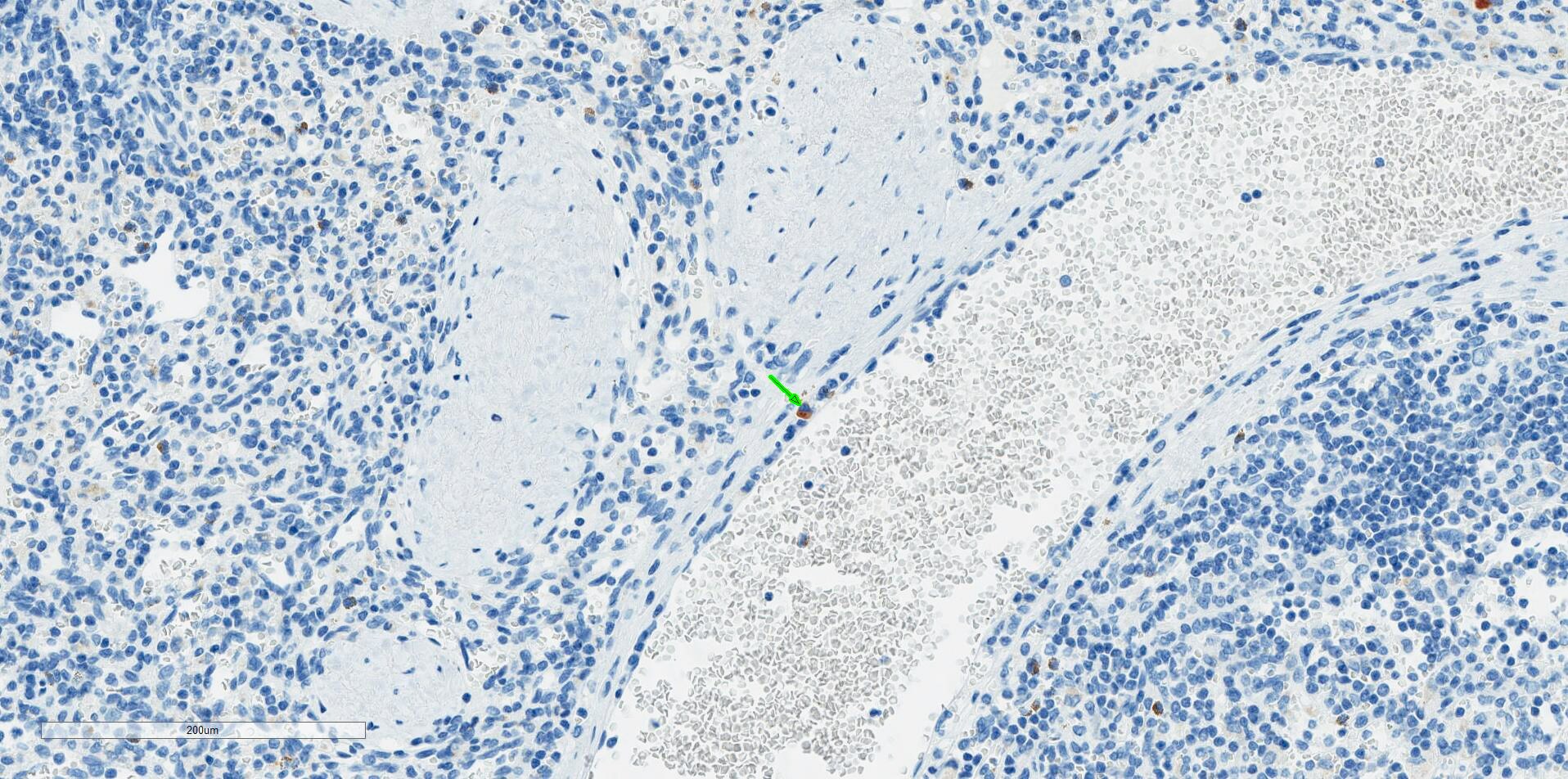 PGLYRP1/PGRP-S Antibody NBP1-20962