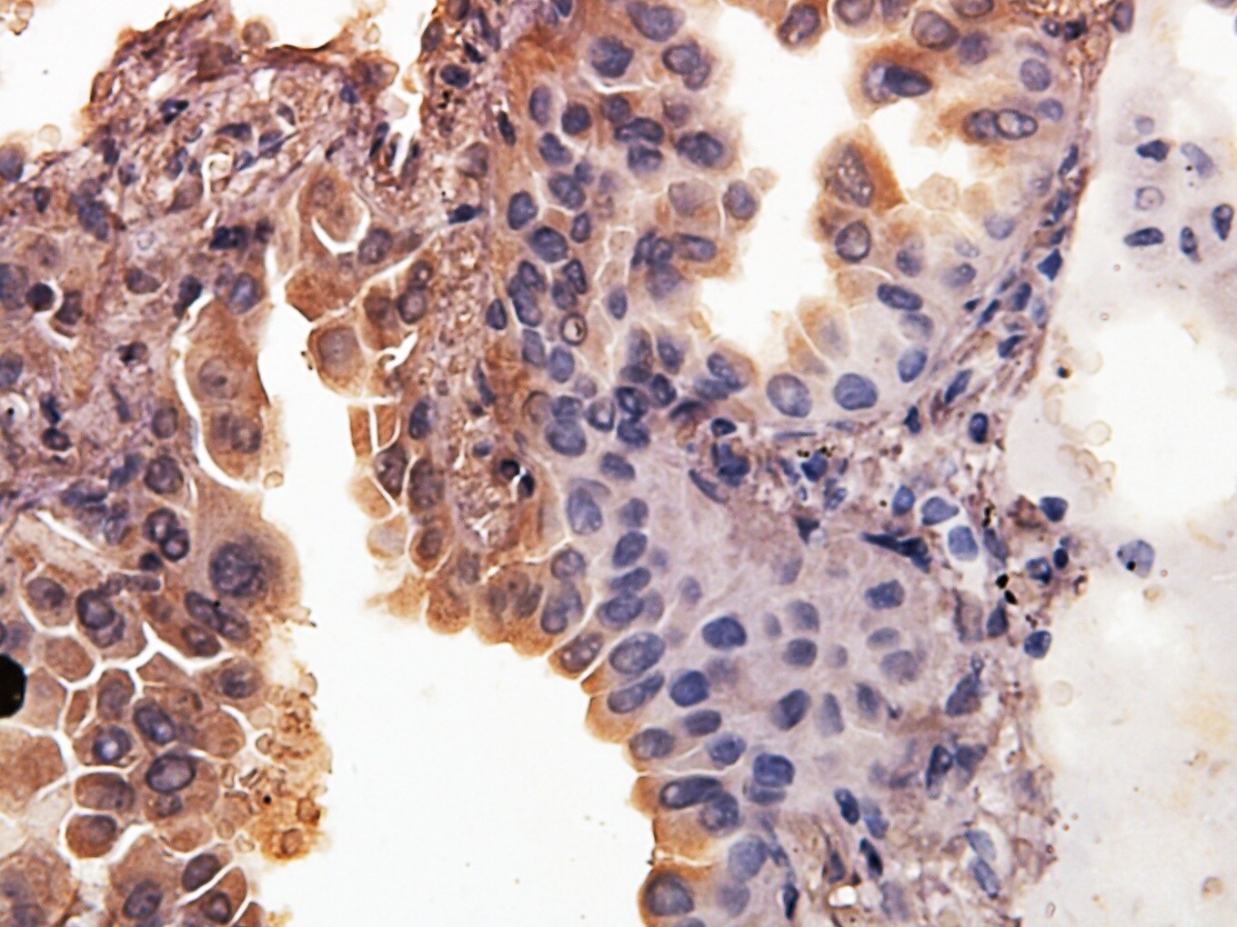 SMAC/Diablo Antibody - BSA Free NB100-56165