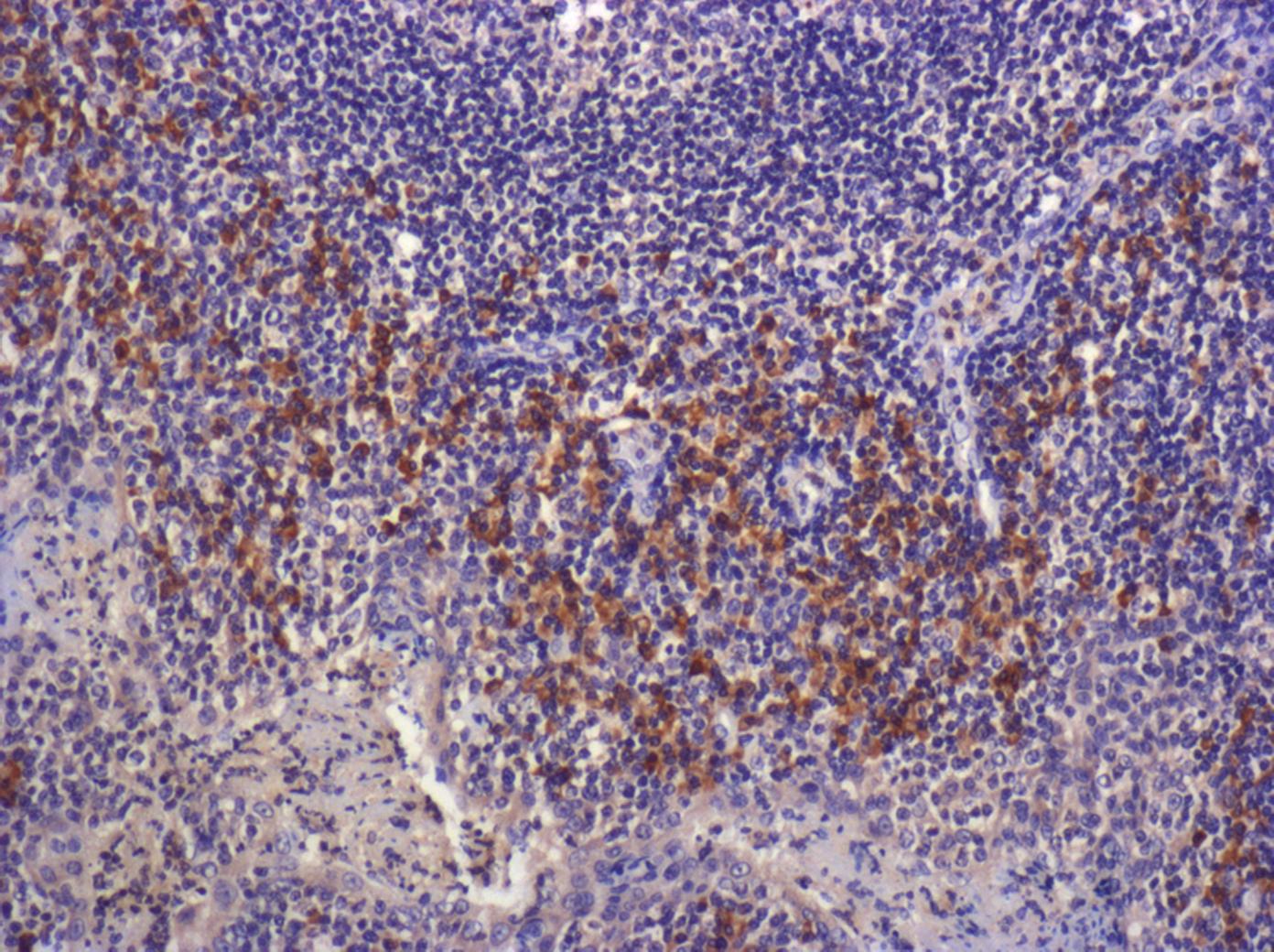 LAP (TGF-beta 1) Antibody (7F6) - BSA Free NBP2-22114