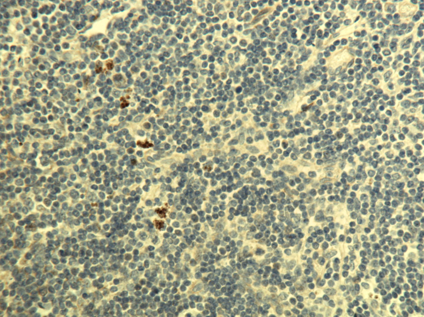 TIMP-3 Antibody NBP2-29478