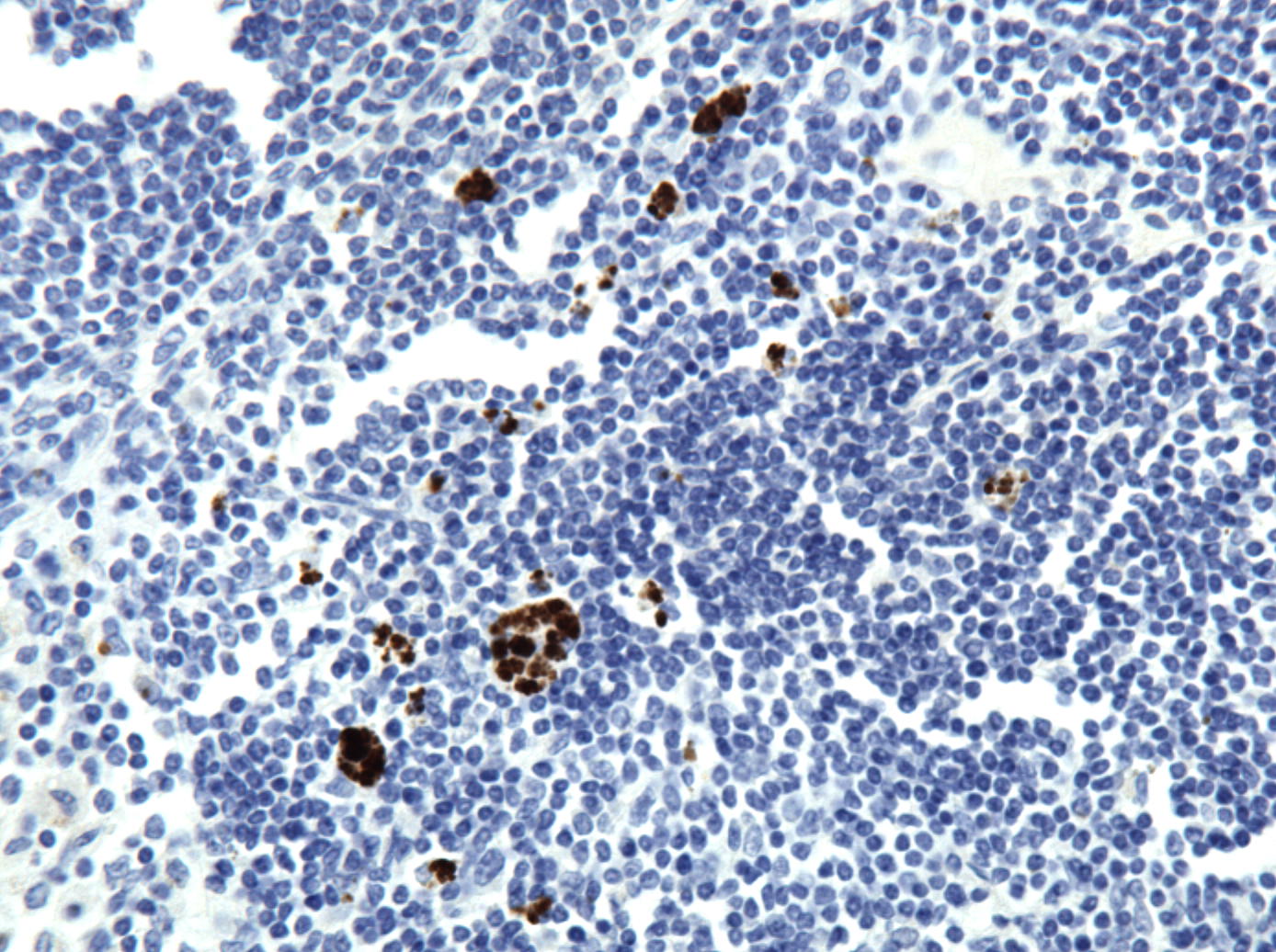 VEGF Antibody (VG76e) - BSA Free NB100-648