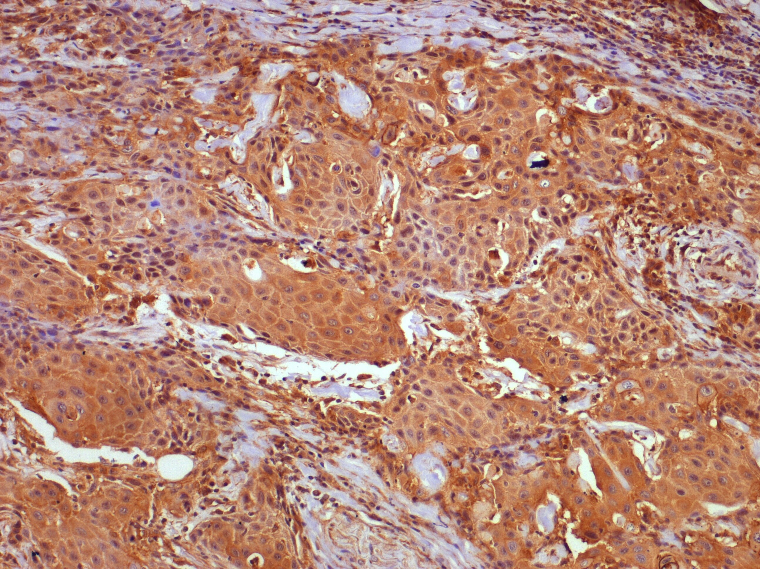 cIAP-2/HIAP-1 Antibody - BSA Free NBP1-27972