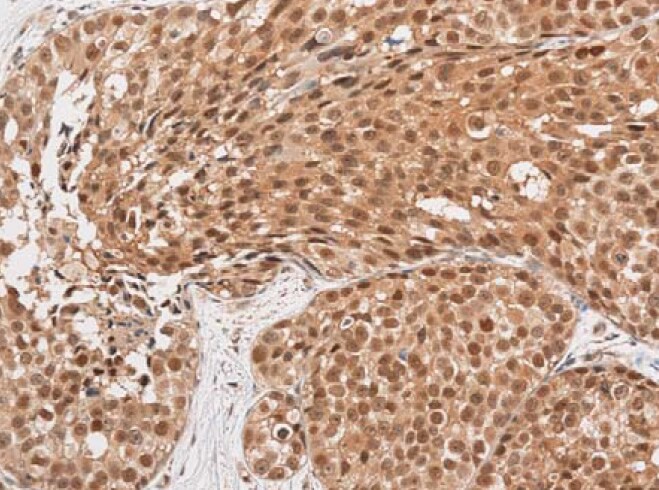 ADPRHL2 Antibody - BSA Free NBP1-88835