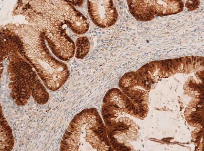 Annexin A10 Antibody - BSA Free NBP1-90156