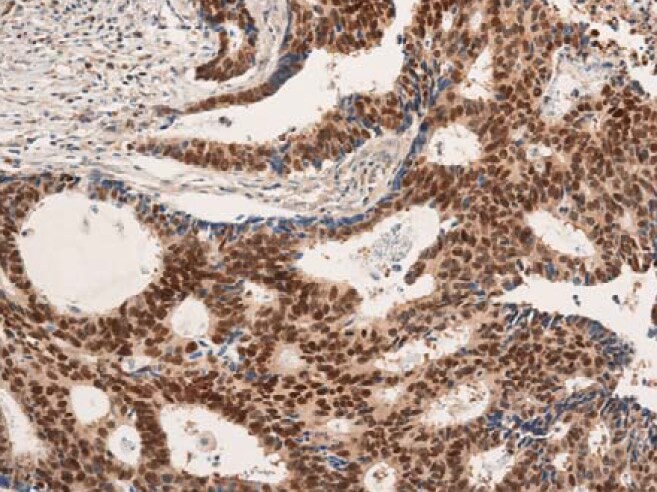 CDX2 Antibody - BSA Free NB100-2136