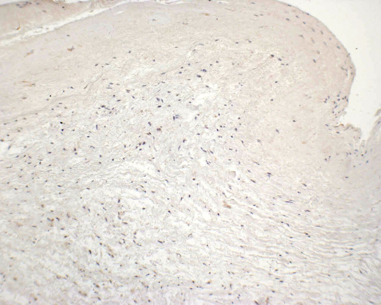 HIF-1 alpha Antibody (H1alpha67) NB100-105