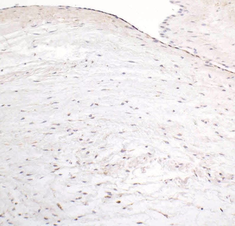 HIF-1 alpha Antibody (H1alpha67) NB100-123